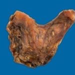 BB HIND HOCK BONE EACH